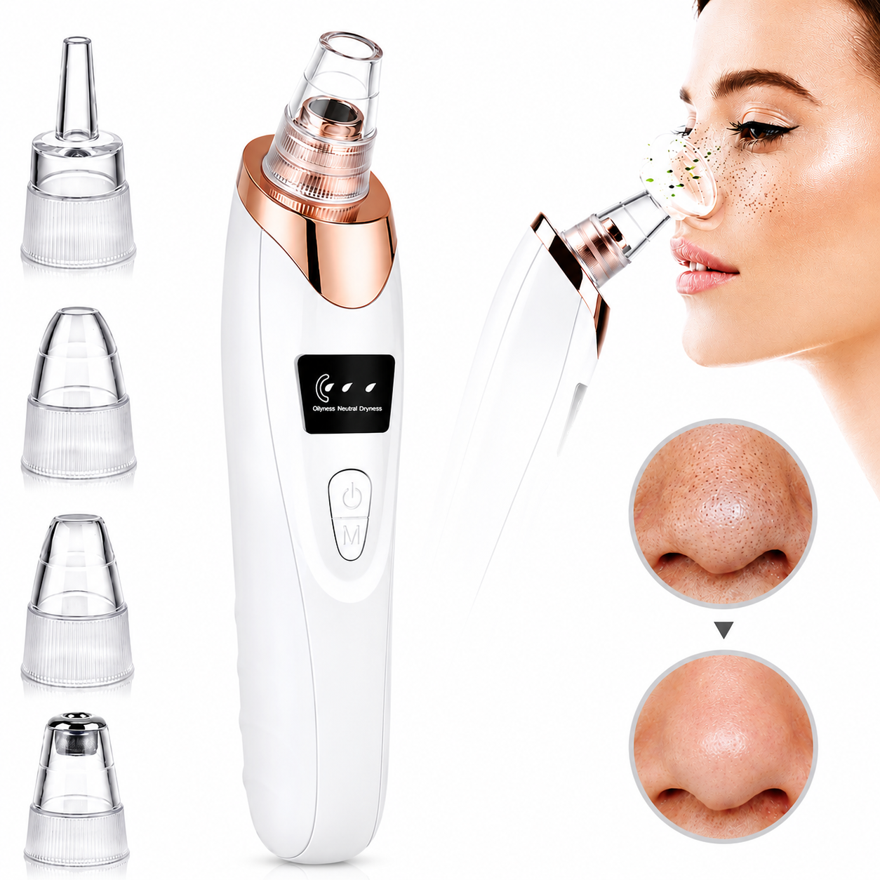 5 in 1 Rechargeable Blackhead Remover and Vacuum Suction Acne Pore Cleaner